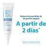 Crema Facial Ducray Keracnyl Glycolic Puntos Negros Espinillas