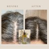 promirose hair Growth oil stimulates hair growth