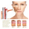 Crema Quitamanchas Hidratante 20g Para Rostro Todo Tipo De Piel
