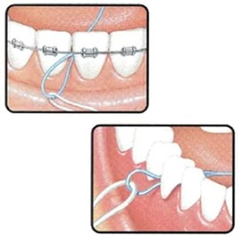 Sunstar GUM Floss Threader #840P Pack of 5