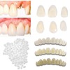 Fake Tooth Repair Kits DIY Dental Care Kit Glue for