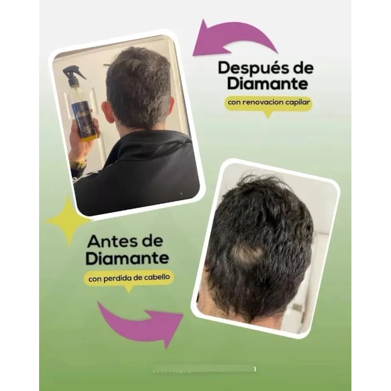 Aceite Puro Colágeno Elastina Reduce Y Evita Estrías Neutra