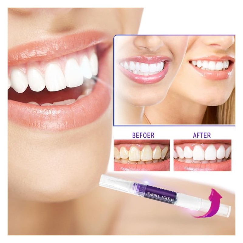Teeth Whitening Pen, Purple Teeth Whitening Pen, Pack of 3,