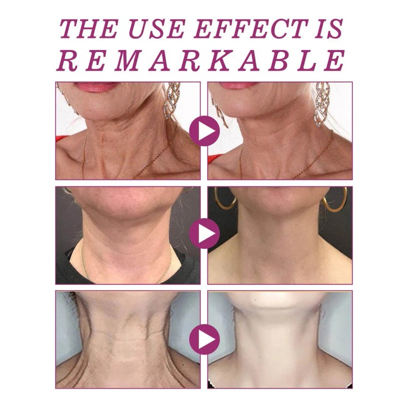 Crema Hidrolizada Para El Cuello, Crema De Belleza, Maquilla