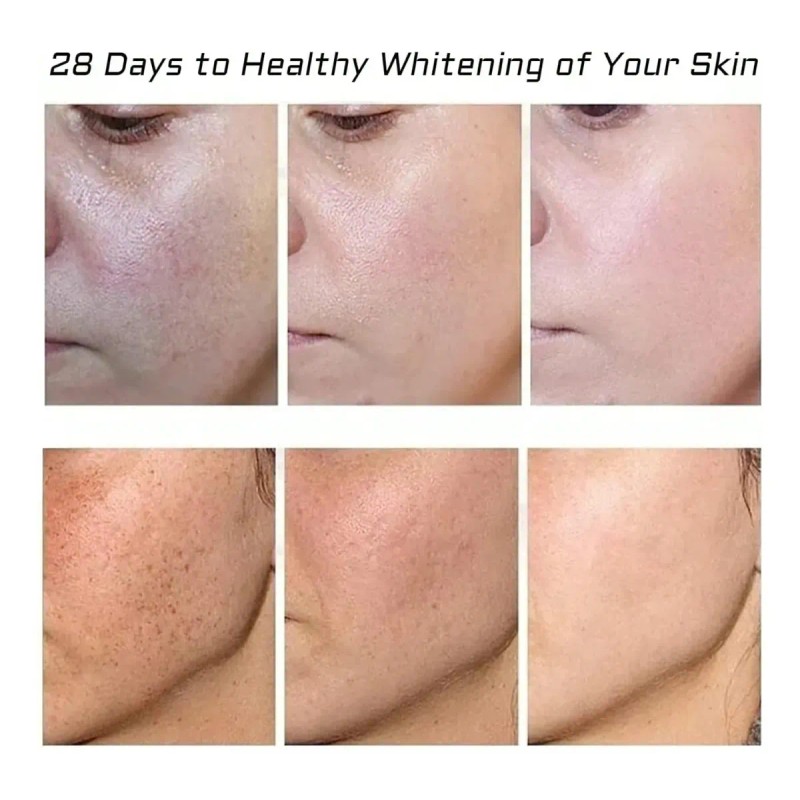 Crema Quitamanchas Hidratante 20g Para Rostro Todo Tipo De Piel