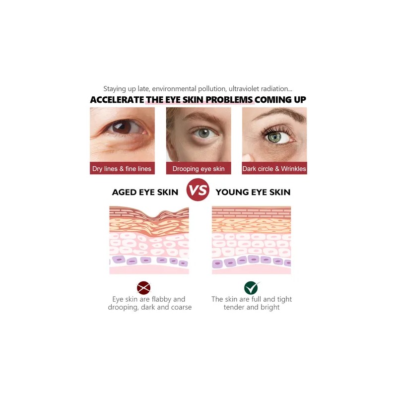 Srum Anticrculo Con Retinol Para Ojeras, Ojeras Y Ojeras