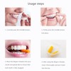 Aligner Chewies for Invisable Aligners, WINDSIUUU 6PCS Silicone Orthodontic Chompers
