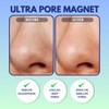 GENDA Blackhead Remover Nose Pore Strips for Deep Cleansing, Hydrocolloid