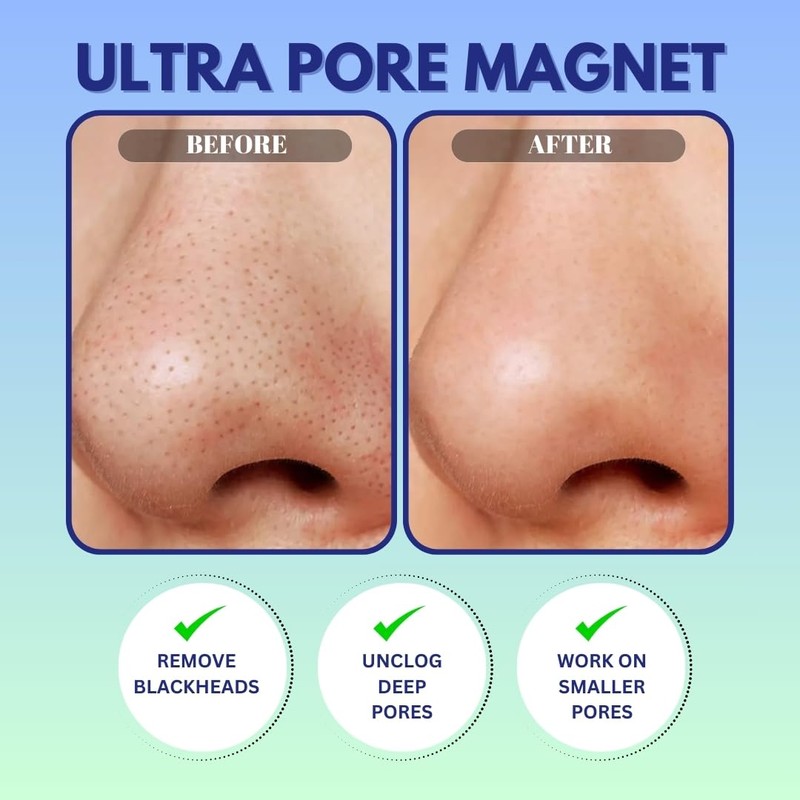 GENDA Blackhead Remover Nose Pore Strips for Deep Cleansing, Hydrocolloid