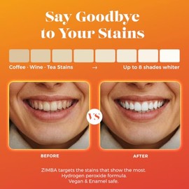 ZIMBA Tiras Blanqueadoras Dentales Menta – Blanqueamiento dental en casa, antideslizantes, veganas – 14 tratamientos (28 tiras)
