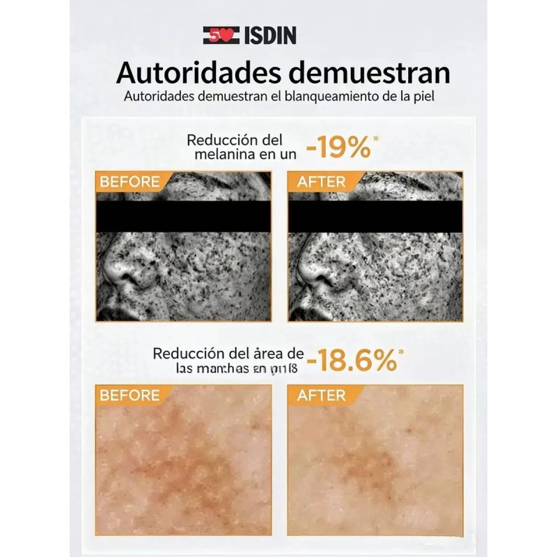Isdin Fotoultra 100 Active Unify Despigmentante Spf50 50ml