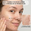 Vivo Per Lei Facial Peeling Gel - Helps Address Dead