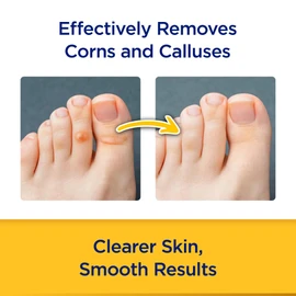 CornStick Maximum Strength Salicylic Acid Solid-Stick Corn and Callus Remover 0.2 Oz