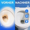 TAIANJI 6 Stück Bimsstein Toilette, Bimsstein Toilettenreiniger mit 2 Griff