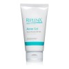 Replenix Acné Soluciones 5% De Peróxido De Benzoilo En Gel,