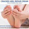 60% Urea Foot Cream for Cracked Heels & Dry Skin,