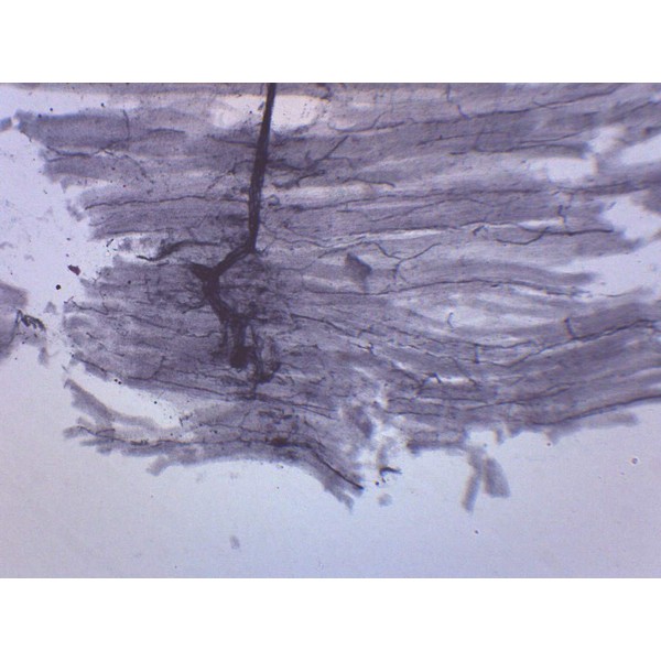 25PK Spinal Cord, Cross Section - Prepared Microscope Slides -