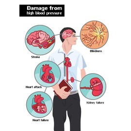 Pressure Guard - The Complete All-Natural Hypertension Supplement to Support Healthy Blood Pressure Level with a Unique Herbal Formulation. 180 Vegan Capsules, Proudly Made in The USA.