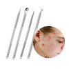 Skin Care Blackhead Extraction Removal 4-Piece Set Tools Sebum Comedo / 피부 관리 블랙헤드 압출 제거 4종세트 도구 피지 기 코 메도