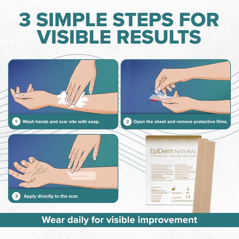 EpiDerm Long Strips Natural Silicone Scar Sheets – Soft, Flexible