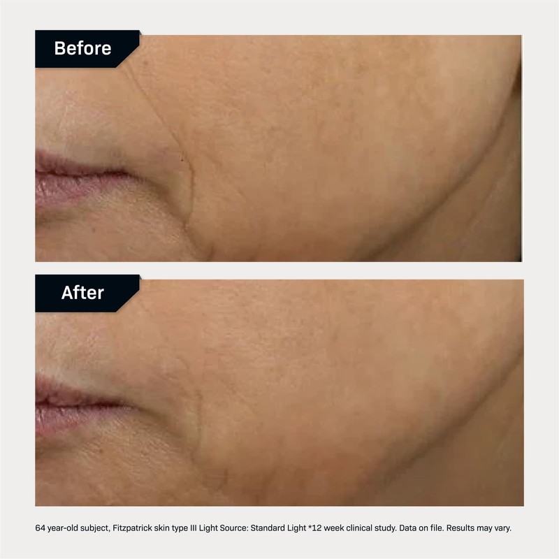 Revision Skincare D·E·J Face Cream®, Advanced Anti Aging Moisturizer, Lifting