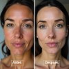 Kit Serum Vitamina C Día + Serum Noche Antimanchas Antiedad