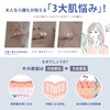 Shishibera Face Pack, 30 Pieces, Large Capacity, Sheet Mask, Exosome,