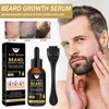 Bartwuchs Kit,Bartwachstum Set mit Dermaroller Bartroller,Bartwuchs Serum Öl/Beard Roller,Beard Growth