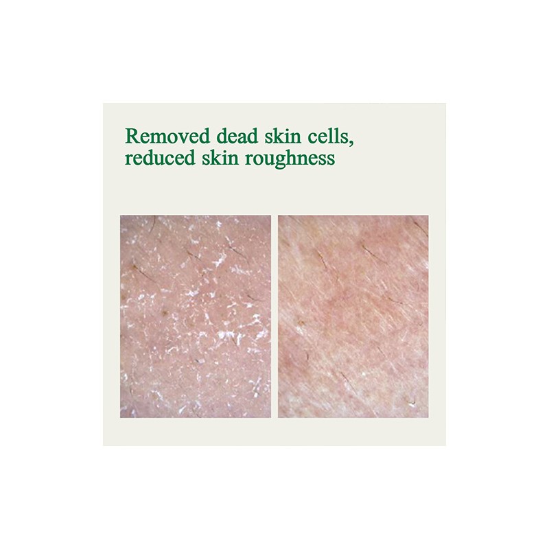 Pyunkang Yul [Pyunkang Yul]Ultimate Calming Solution Ampoule 30ml