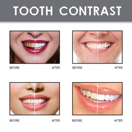 ouhoe Paint Instant Tooth Whitening Paint Instant Whitening Paint for TeethCaberi - Specification: 1pcs