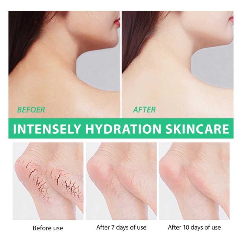 W Urea 40% Crema De Urea Cream Hidratante