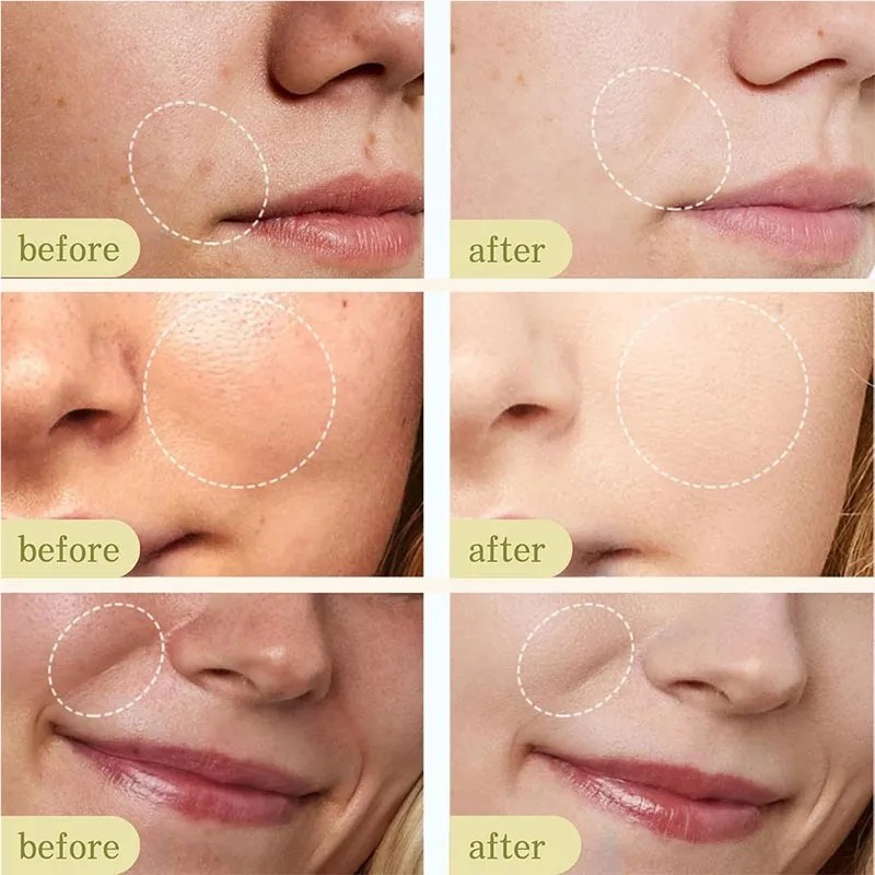 Hidratante Facial Con Glutatión 45 G 1 Unidad