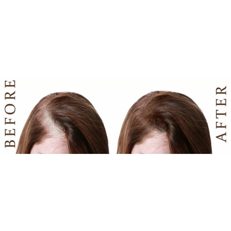 FIT FORLIFE DHT BLOCKER Promotes Fast Hair Growth Pills Supplement