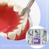 30 Piece Dental Anterior Matrix Kit with Proximal Strips and
