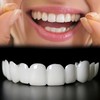 2 Pairs, Adjustable for Men and Women, Regain Confidence Smile,