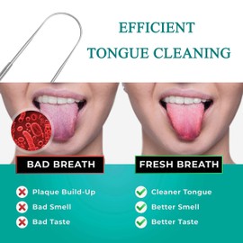 chongning Tongue Scraper with Travel Case 2 Pack, Bad Breath Treatment Tongue Scraper for Adults & Kids, Stainless Steel Metal Tongue Scraper, Easy to Use Tongue Cleaner for Hygiene and Self Care