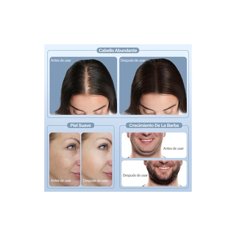 Sello de Microagujas 0.25 mm, Alternativa al Rodillo de Microagujas,