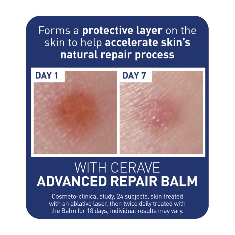 CeraVe Advanced Repair Balm 50mL