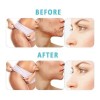 Derma Roller 0.5 Mm Facial Dermaroller Barba
