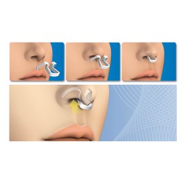 Anti Snoring Nose Dilator, Snoring Stopper Medium and for Sports - Tested by the Italian Olympic Committee - Made in Italy - Startup Kit