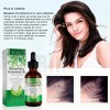 Aceite Esencial De Romero Crecimiento Cabello Cuidado Piel
