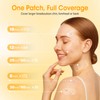 JOLVKA Pimple Patches for Face, 368 Counts 5 Sizes Large