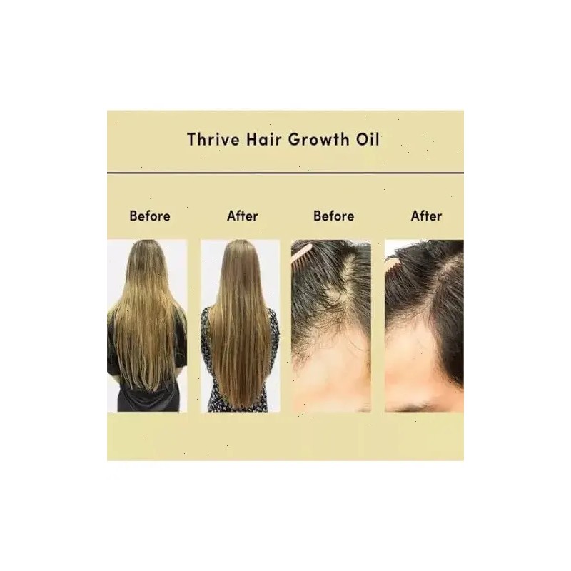 Aceite Vegano Natural Para El Crecimiento Del Cabello