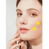 Parches Antiacné Acne Patche Hydrocolloid Para Rostro, Pack 600 Unidades