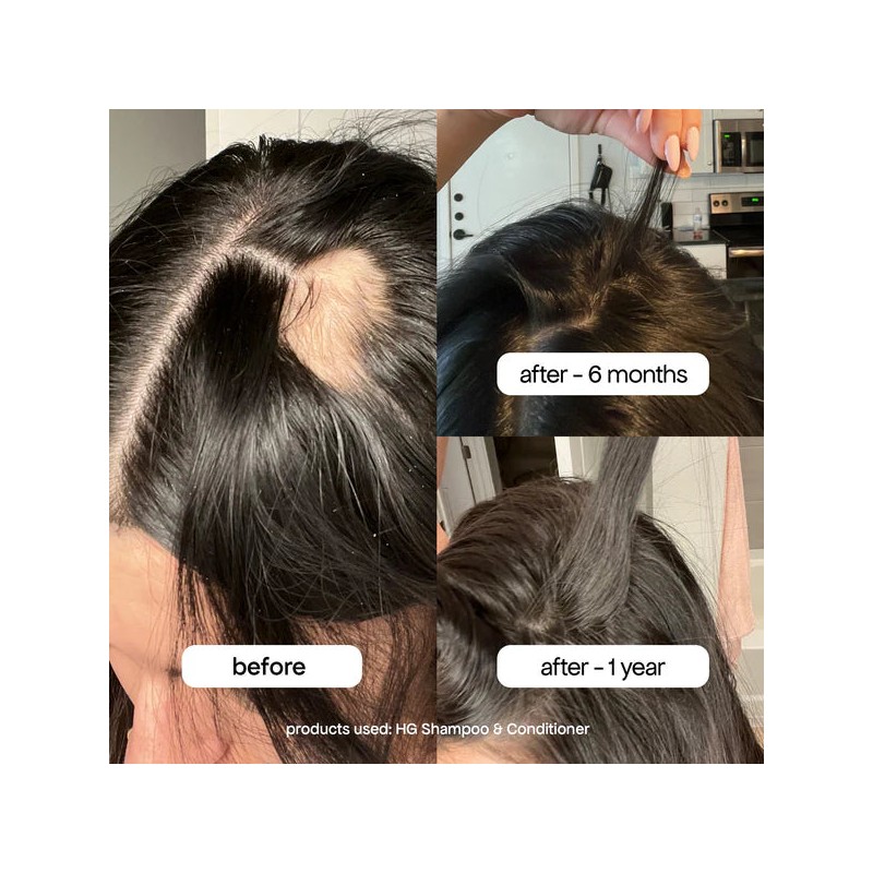 Bondi Boost Hair Growth Conditioner 300ml