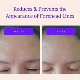 Blumbody Forehead Wrinkle Patches - Anti Wrinkle Facial Patches to Smooth Eyes & Forehead Wrinkles - Non-Silicone Face Tape for Fine Wrinkles between Eyes & Face - 50 Forehead Face Patches (Up to 60 day supply)