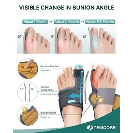 1 Pair Bunion Corrector Big Toe Straightener With 2 Angle Plates Day Night