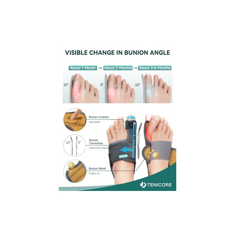 1 Pair Bunion Corrector Big Toe Straightener With 2 Angle