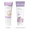 Crema Intensiva Para Estrías Mom To Mom B