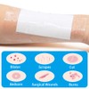 Waterproof Bandage, Large Clear Adhesive Dressing, 4 * 6inch 10pcs